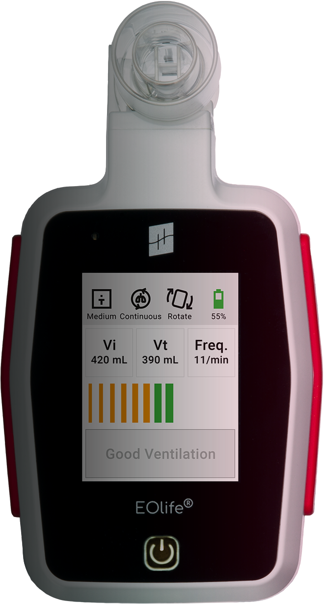 eolife-prod-fiche-HD-EN EOlife: The only Ventilation Feedback Device (VFD) to measure the volume of gas reaching the patient’s lungs (TIDAL VOLUME)
